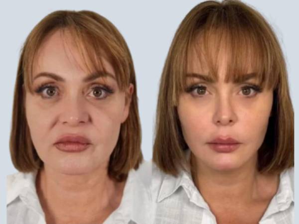 Gaby Spanic generó gran reacción en redes tras mostrar los resultados de su reciente paso por una clínica especializada en São Paulo, Brasil. La actriz venezolana exhibió comparativos en sus historias de Instagram que evidencian cambios en su rostro y silueta facial, despertando comentarios sobre su aspecto rejuvenecido.