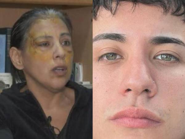 Paula Jasolvec, es una madre argentina que recientemente confesó vivir en un calvario desde que su hijo, Santiago Jasolvec, la atacó a disparos y puñaladas. El episodio que parece sacado de una película de terror se remonta al pasado 13 de junio, en Lanús, una ciudad de la provincia de Buenos Aires, Argentina.