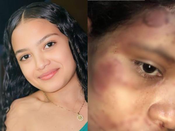 Con tan solo 19 años de edad, Dayani Acosta vive con temor por su vida y la de sus dos pequeños, luego de recibir amenazas de su expareja y de la familia de él, tras haber sido atacada a mordidas y mantenida encerrada en su vivienda. Esto relató su madre.