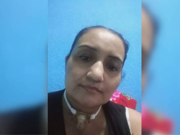 Tras meses hospitalizada, Carolina requiere una cordectomía posterior en clínica privada; tu ayuda económica le permitirá hablar y respirar mejor.