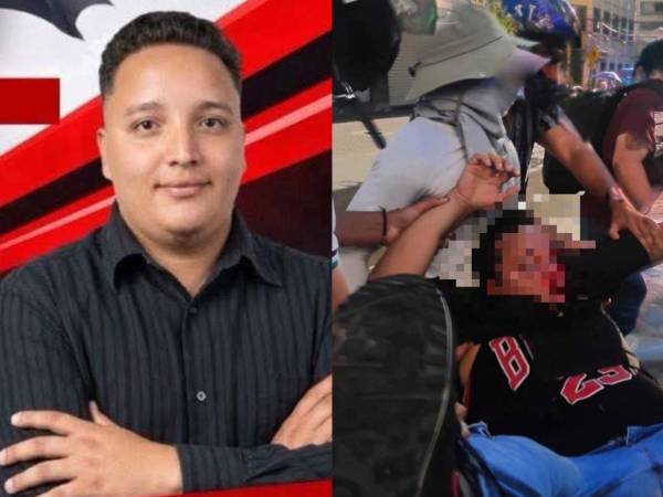 El pasado lunes 20 de abril, un estudiante de la carrera de Trabajo Social de la Universidad Nacional Autónoma de Honduras (UNAH) perdió un ojo tras una protesta derivada de presuntas amenazas de recorte al presupuesto de la institución. La acción terminó en un enfrentamiento entre los universitarios y agentes de la Policía Nacional y la Policía Militar. ¿Quién es el joven que resultó afectado? Aquí los detalles.