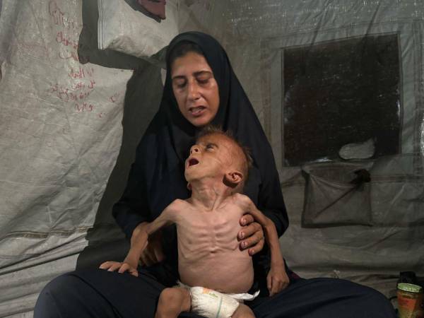 Según informes de agencias internacionales, en Gaza más de uno de cada tres personas pasan días sin poder comer