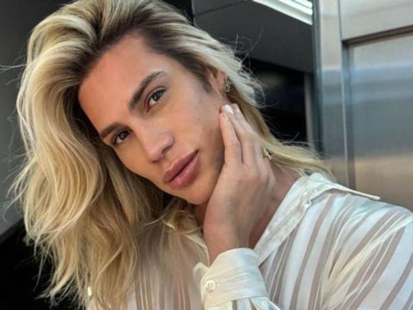 Esta semana, familiares dieron a conocer la muerte del influencer y estilista brasileño, Adair Mendes Dutra Junio, de 31 años de edad, debido a complicaciones derivadas de una cirugía estética foxy eyes (mirada de zorro).