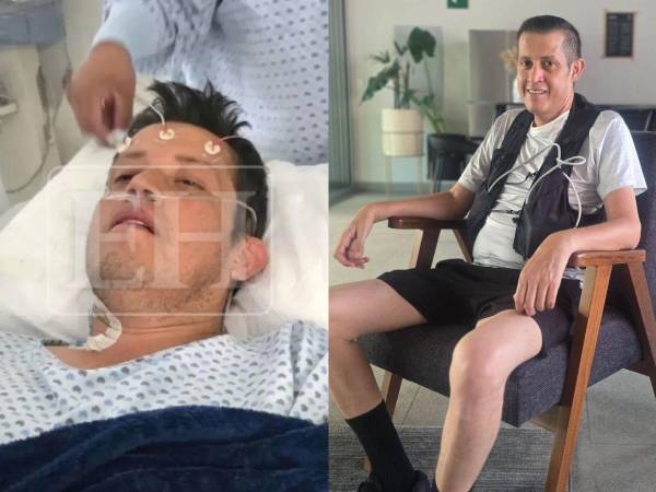 ¿Cómo quedó el diputado de Libre, Octavio Morales Bonilla, quien ocupaba L10 millones para un corazón artificial? Esto es lo que se sabe de él en cuanto a su salud y si pudo recuperarse.