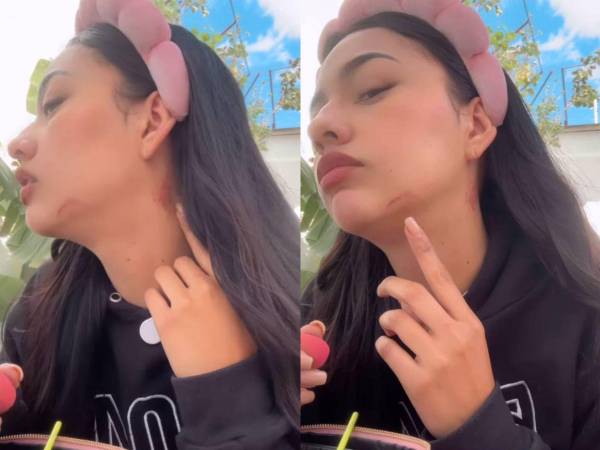 La presentadora hondureña Kennia Mondragón denunció a través de sus redes sociales que fue víctima de una agresión física por parte de Brayan Silva, el mejor amigo de su pareja.