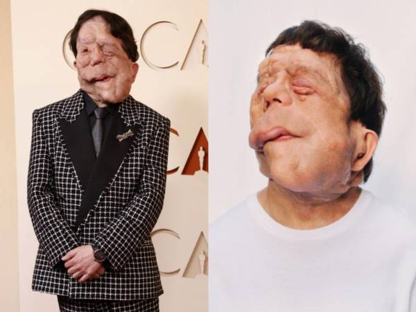 Adam Pearson caminó por la alfombra roja de los Premios Oscar 2026, llevando un mensaje de inclusión y resiliencia a uno de los escenarios más importantes del cine mundial.