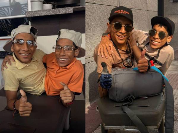 José Luis y José Armando Cevallos nacieron unidos físicamente y compartían órganos como el hígado y el intestino, aunque cada uno tenía su propio corazón.