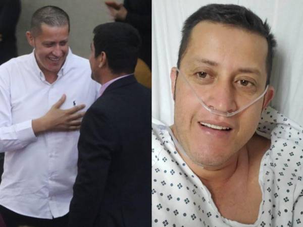 Octavio Morales, diputado de Libertad y Refundación (Libre), regresó al Congreso Nacional (CN) tras haber permanecido en México en busca de un corazón artificial. El parlamentario detalló cuánto se gastó finalmente en su tratamiento.