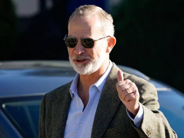 Su cirujano asegura que la recuperación es rápida. Solo necesitará unas gotas, gafas de sol y evitar esfuerzos bruscos durante unos días.