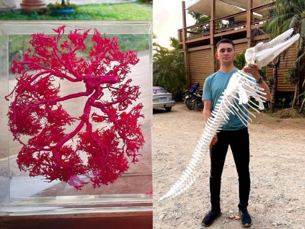 El hondureño, Fredy Chávez, crea obras excepcionales en las que combina la ciencia con el arte y la anatomía. Puede transformar la placenta de una madre en una pieza artística y huesos de seres vivos en esculturas sorprendentes. A continuación más detalles de su proyecto que se adentra en un terreno fuera de lo convencional para crear recuerdos únicos y personalizados.