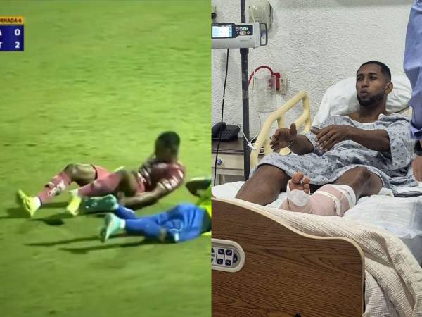 Romario da Silva, futbolista de Motagua, fue operado luego de la espantosa lesión que sufrió la noche del 12 de mayo ante Potros de Olancho. ¿Volverá a jugar profesionalmente? Esto es lo que se sabe.