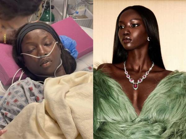 La supermodelo Anok Yai fue hospitalizada recientemente debido a complicaciones de salud que venía ignorando desde hace meses.