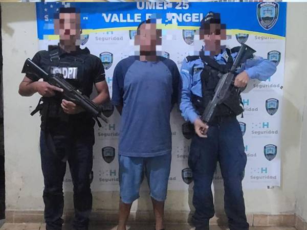 El sospechoso fue detenido luego de que le arrancara la oreja a un hombre en Valle de Ángeles.