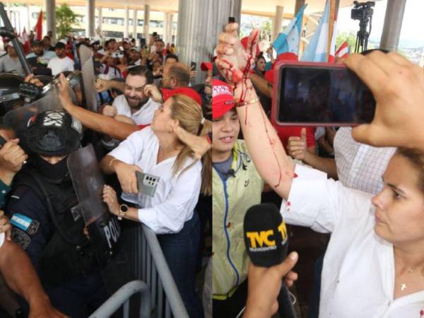 La crisis electoral arreció este miércoles -30 de julio- en la capital hondureña, entre gritos, zafarrancho, represión policial y hasta sangre, luego que diputados, activistas y simpatizantes del Partido Liberal se movilizaron al Congreso Nacional y fueran agredidos por la Policía Nacional y seguridad privada del Poder Legislativo. ¿Quién es la fémina que resultó ensangrentada?