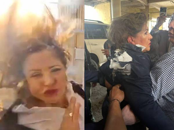 La diputada cayó al suelo tras recibir el fuerte impacto en su cuello y espalda y tuvo que ser auxiliada por sus compañeros.