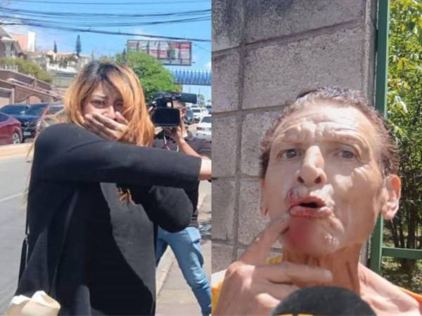 Un intento de asalto protagonizado por una pasajera armada con un arma blanca dejó a un taxista con golpes en el rostro la tarde de este martes 10 de marzo en Tegucigalpa, capital de Honduras, según denunció el propio conductor tras el incidente.