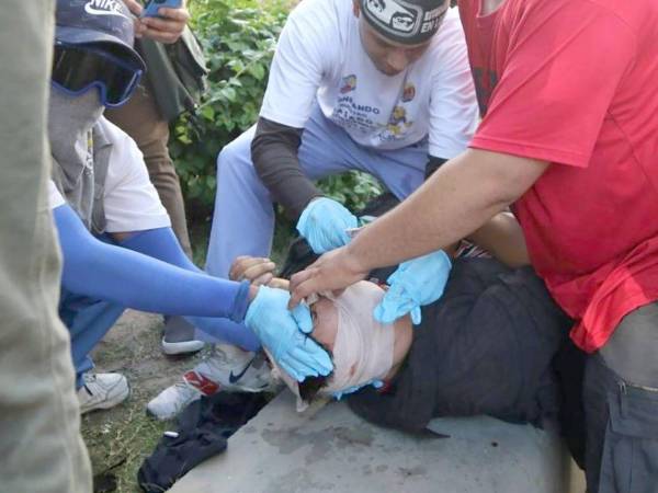 Axel Josué Medina Castellanos, estudiante de la carrera de Trabajo Social y presidente del comité estudiantil, fue herido en una protesta estudiantil.