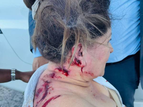 ¿Quién atacó a Gladis Aurora López, diputada del Partido Nacional, con un explosivo? Esto es lo que se sabe hasta el momento sobre el condenable hecho hacia la diputada nacionalista al Parlacen.