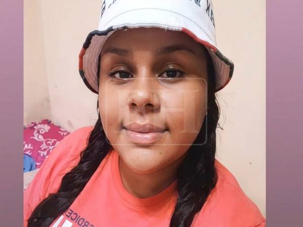 Rostro de Winiker Elena Galeas Alvarado.