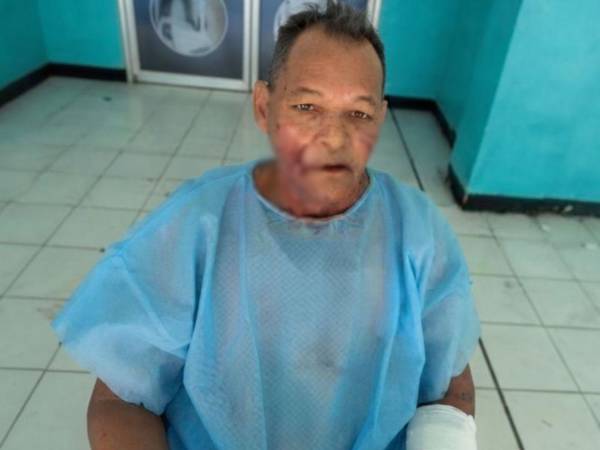 De acuerdo con el relato de César Chávez, los tres perros también atacaron a otras dos personas.