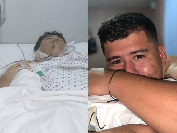 Pese a las operaciones realizadas para salvar su vida, Brayan Fernández falleció la noche del martes en el hospital Mario Catarino Rivas, luego de permanecer varios días hospitalizado.