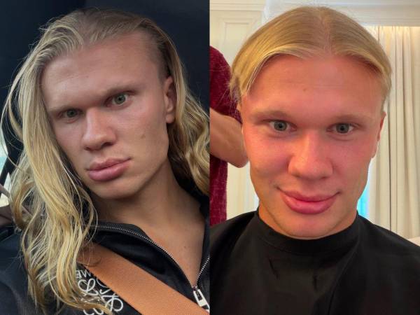 Erling Haaland sorprendió a sus millones de seguidores al mostrar un radical cambio de imagen. ¡Adiós a la icónica cabellera rubia!