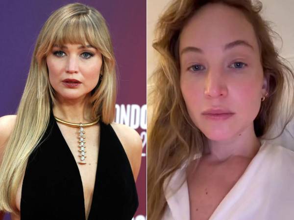 Jennifer Lawrence detalló en una entrevista los tratamientos estéticos que se ha practicado, desde el bótox hasta una elevación de pecho.