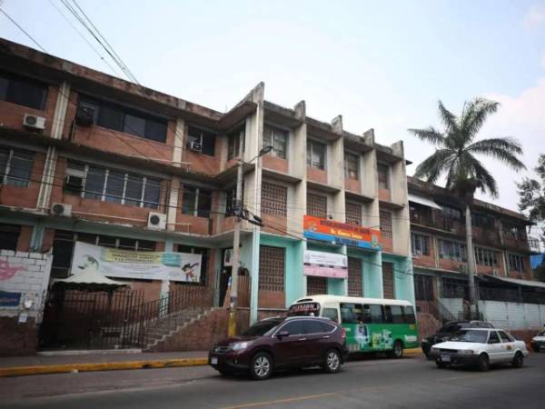 El área de Rayos X del Centro de Salud Alonzo Suazo se mantiene activa en la atención de pacientes con tuberculosis, realizando diagnósticos clave para controlar la enfermedad en el Distrito Central.