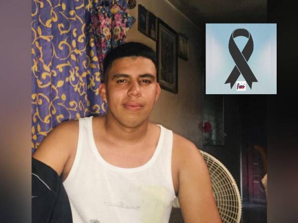 Rostro en vida del agente Alex Mauricio Amador Baca, accidentado en Sabanagrande, FM.