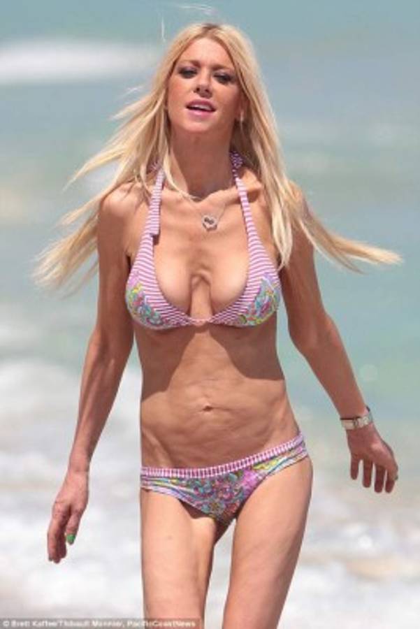 Famosa actriz de Hollywood es víctima de la anorexia