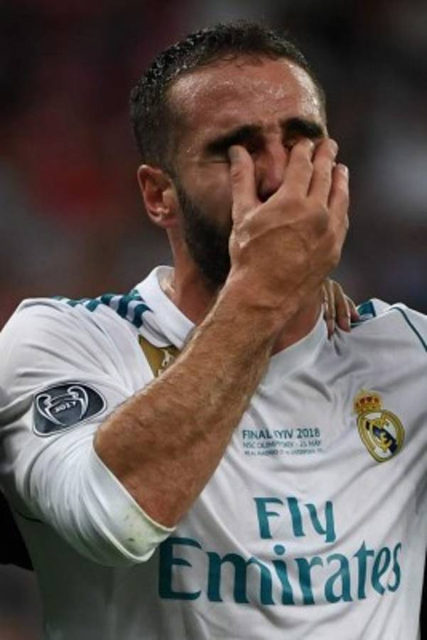 El defensa del Real Madrid, Dani Carvajal, llora al sufrir lesión en Champions. Foto AFP