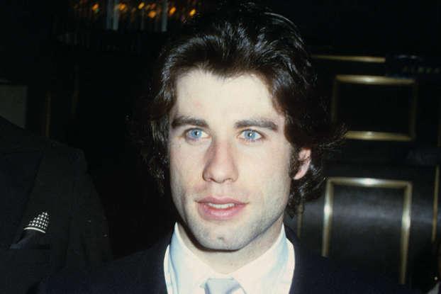 Antes y después: así lucían los famosos calvos