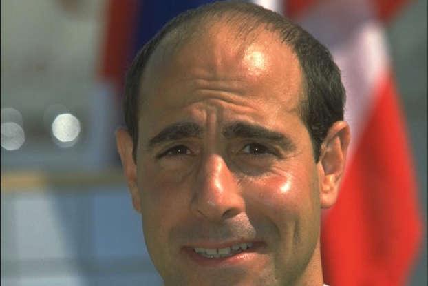 Antes y después: así lucían los famosos calvos