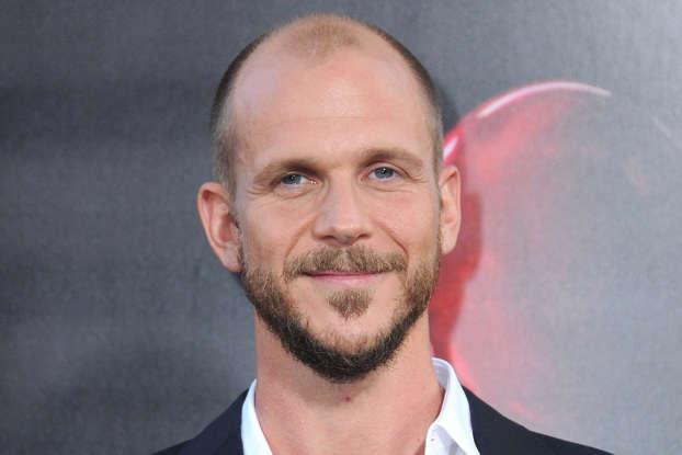 Antes y después: así lucían los famosos calvos