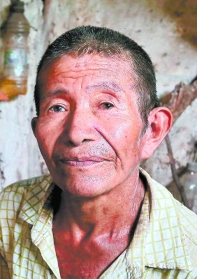 Hambre acecha en Texíguat