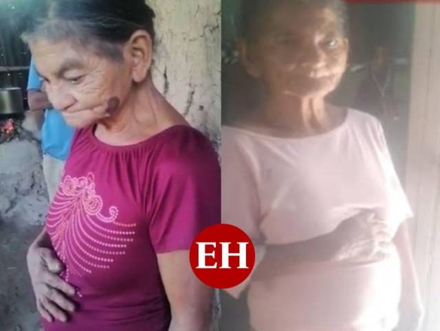 Hondureña de 62 años asegura tener seis meses de embarazo en Comayagua