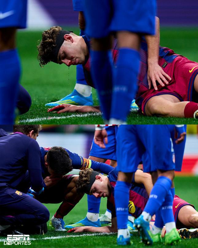 Culpable del fracaso de Barcelona, jugador sale herido y sufrimiento de Lamine Yamal ante Atlético