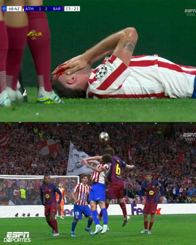 Culpable del fracaso de Barcelona, jugador sale herido y sufrimiento de Lamine Yamal ante Atlético