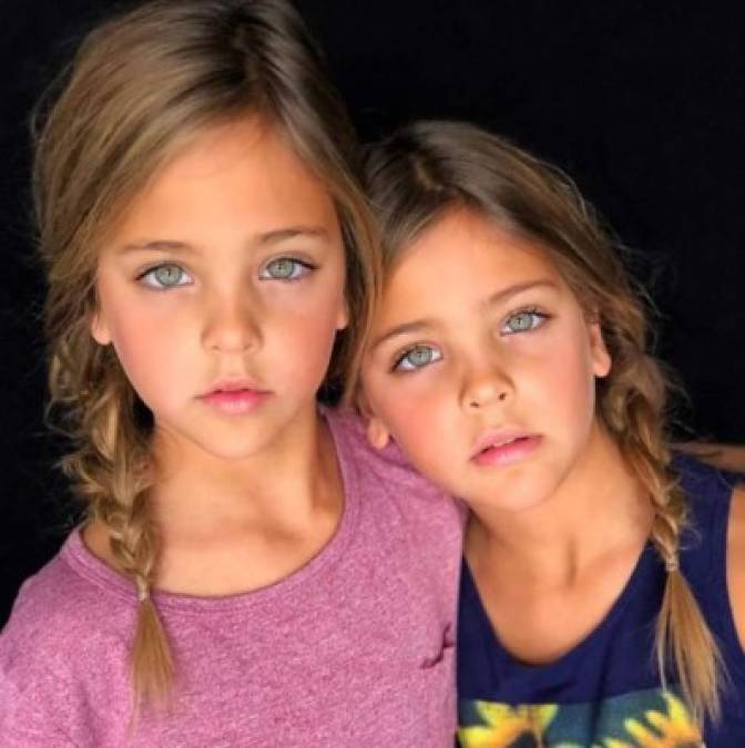 FOTOS: Leah Rose y Ava Marie, las gemelas más bellas del mundo, son sensación en Instagram