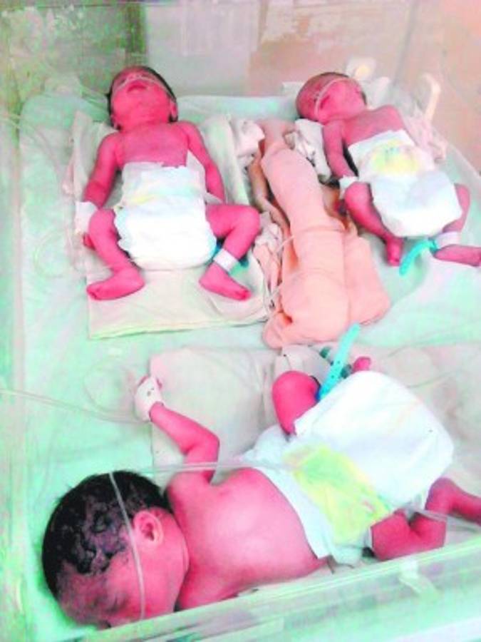 Honduras: Trillizos siguen en observación