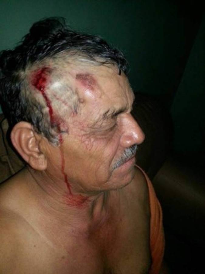 Denuncia: Rapidito casi mata a sexagenario y se da a la fuga