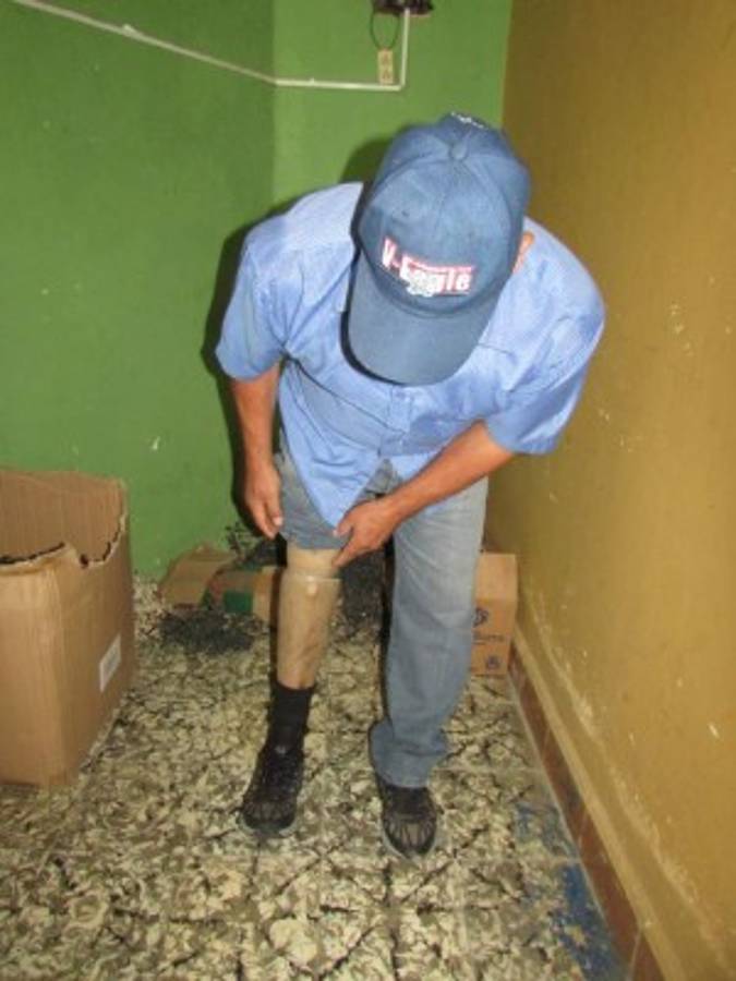 Afectados por la guerra urgen de prótesis en Alauca, El Paraíso