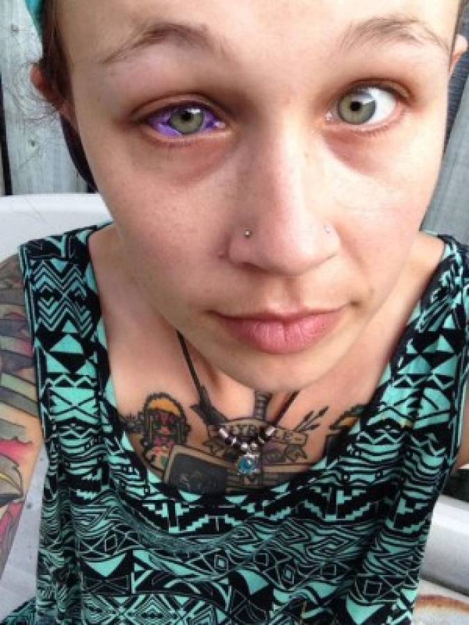 Quería verse diferente, se tatuó los ojos y sufrió las terribles consecuencias