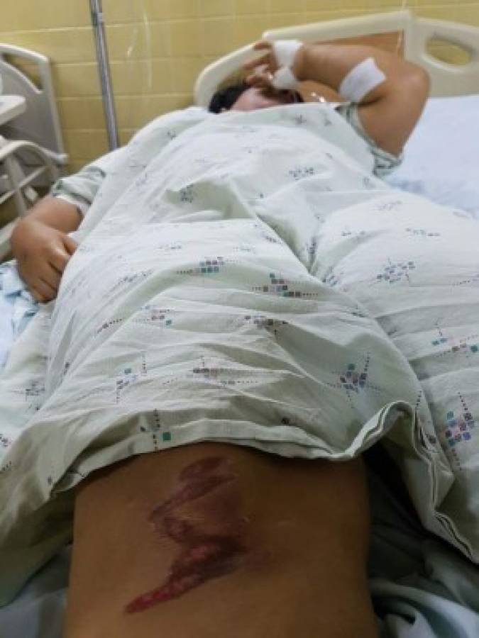 Tegucigalpa: Siete heridos por el caos en el estadio Nacional abandonan el Hospital Escuela Universitario