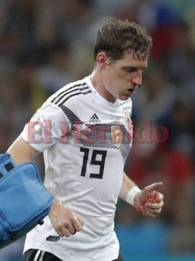 Alemania vs Suecia: Así fue la patada que Ola Toivonen le dio en la cara a Sebastián Rudy