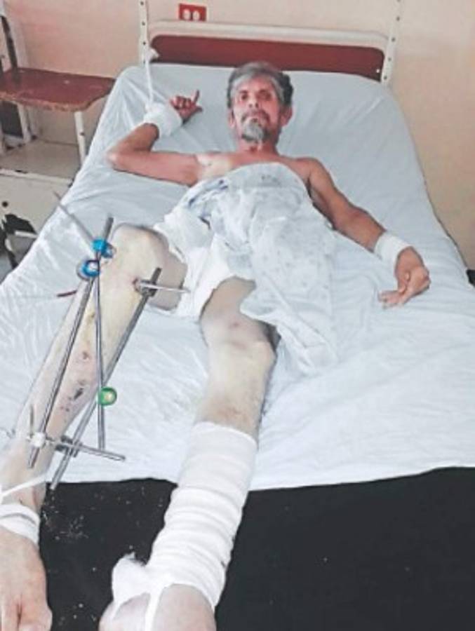 Honduras: Medicina Forense reconoce que entregaron un cadáver equivocado