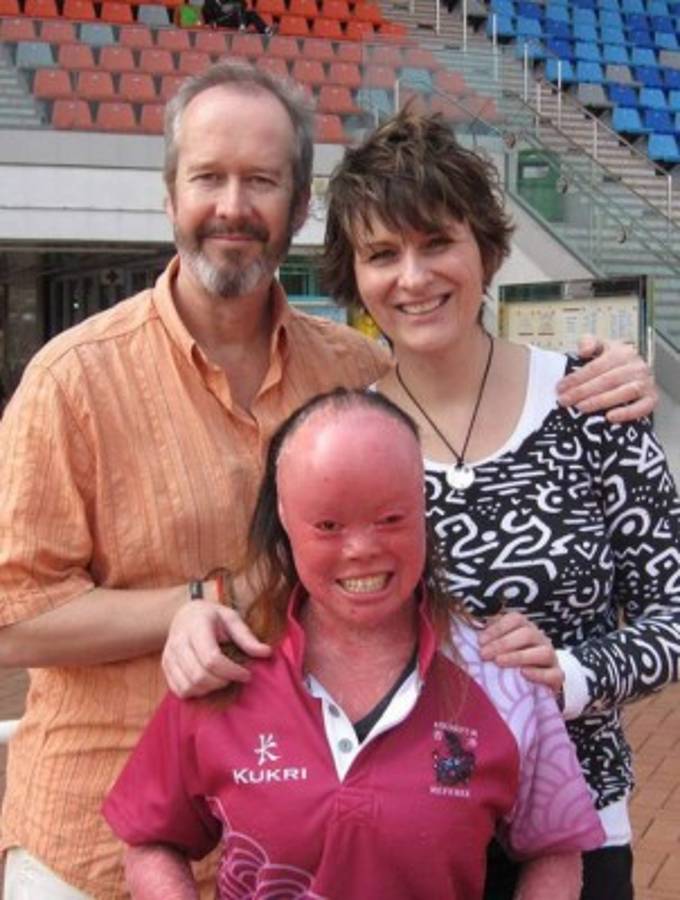 Escondió su rostro por 22 años