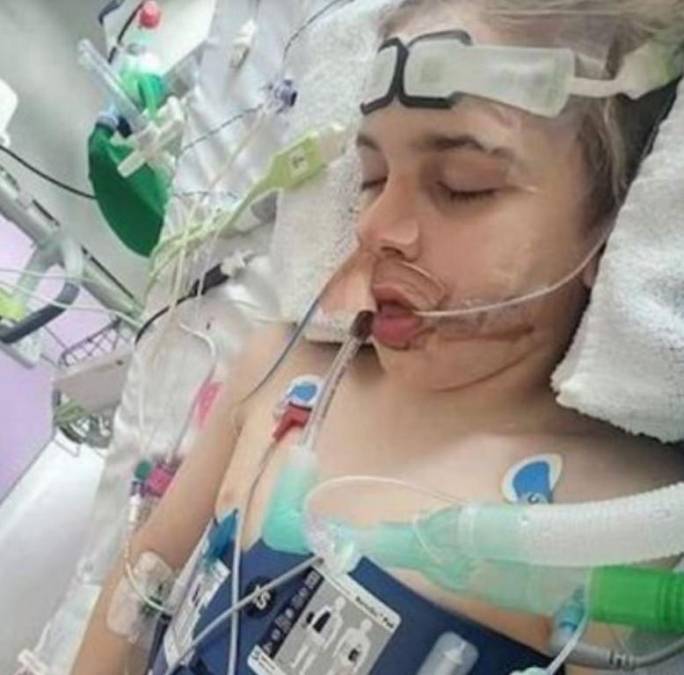 Polémico caso de Archie Battersbee: ordenan desconectar a niño que sufrió muerte cerebral durante reto viral