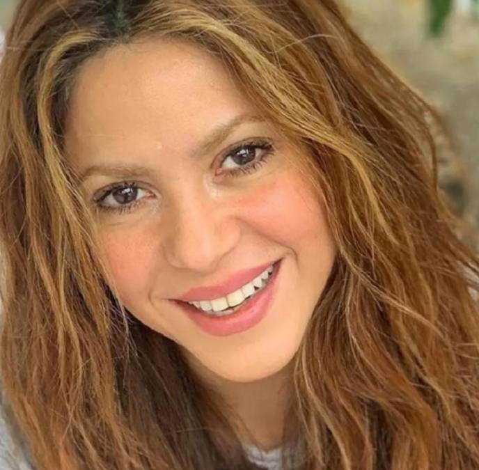 ¿Bótox?: Estos son los retoques que Shakira se ha hecho en la cara