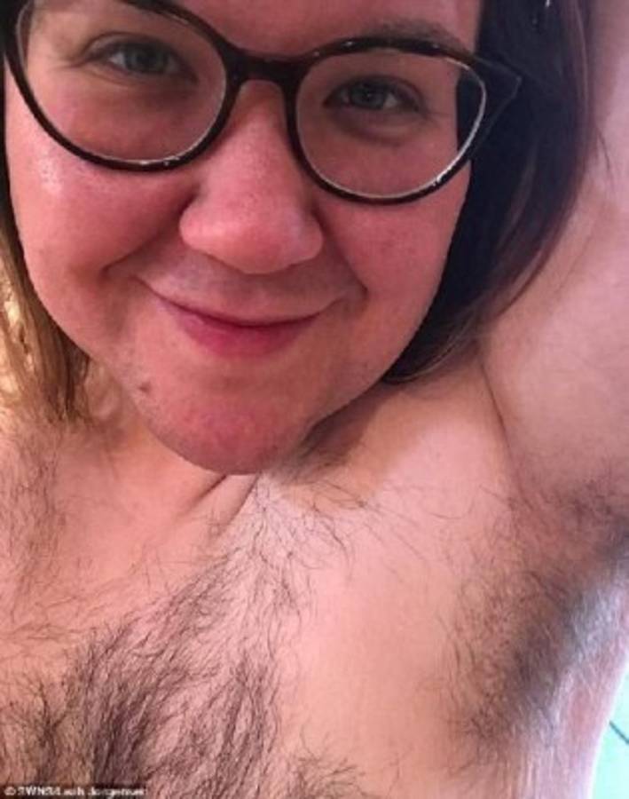 La mujer muestra su cuerpo lleno de vellos, los cual trató de evitar toda su vida.